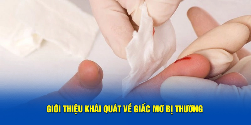 Giải Mã Giấc Mơ Bị Thương - Mơ Bị Thương Do Đâu 2 Giới thiệu khái quát về giấc mơ bị thương